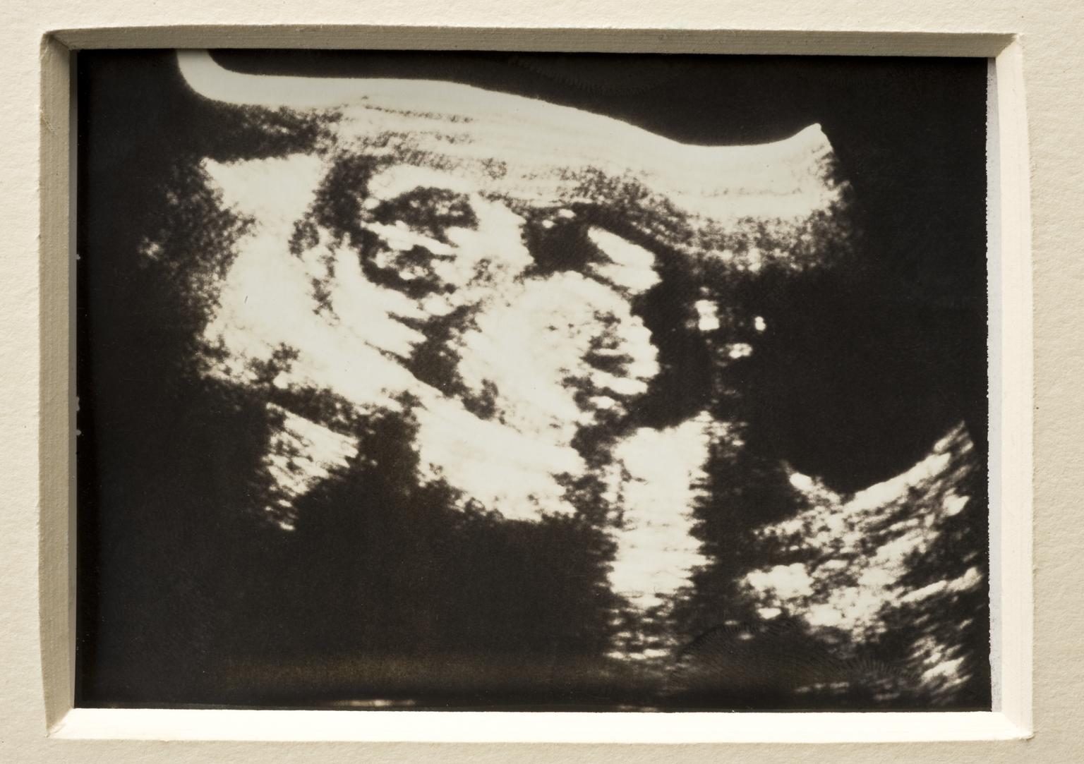 Life in a Lab: Trump’s IVF Order and the Loss of Moral Clarity